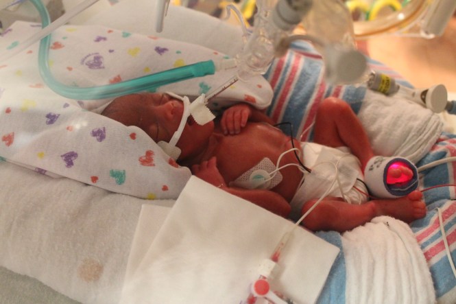 Michaela's 1st picture! She weighted 1 pound, 14.5 ounces at birth.