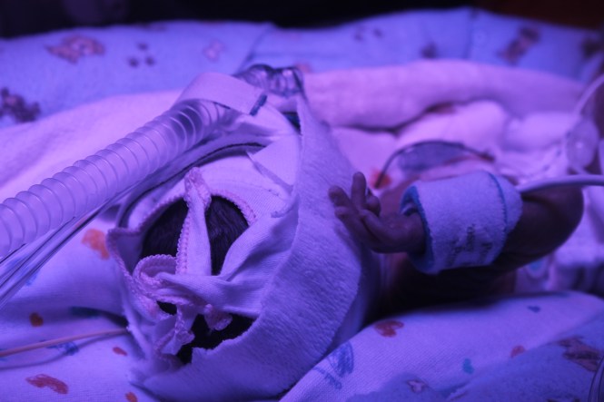 They've each got a full head of wavy hair.