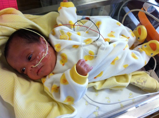 The fashion show begins for Michaela... hoping she'll lose that feeding tube accessory soon.